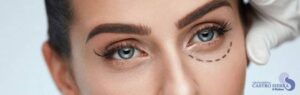 blefaroplastia cirugia ojos madrid